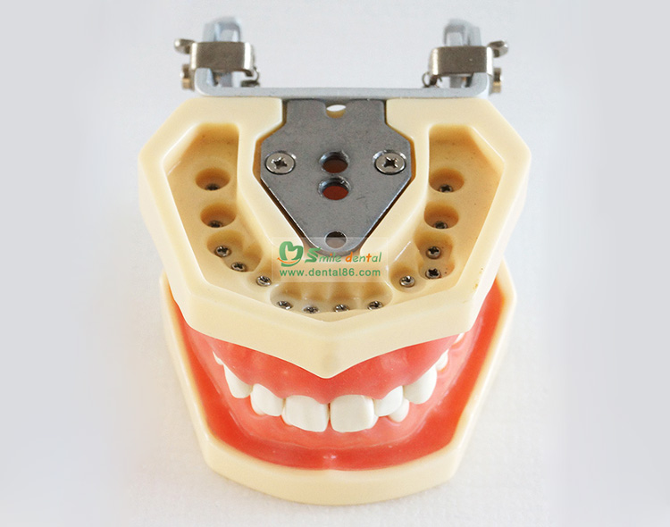 TM-A14 Standard Model